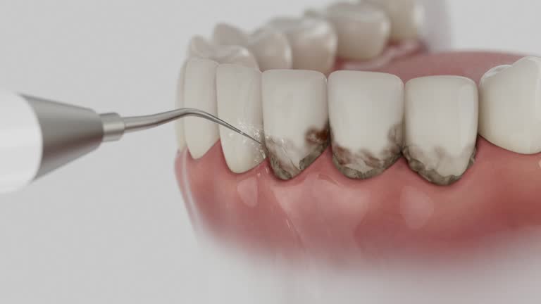 Trusted Teeth Cleaning And Checkup service in Citrus City, TX - Dentist Open Now